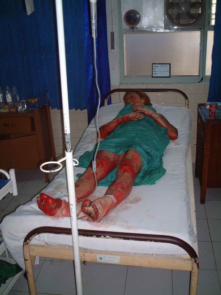 File:Bali-sangla-hospital-09.jpg