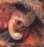 Human Embryo.jpg